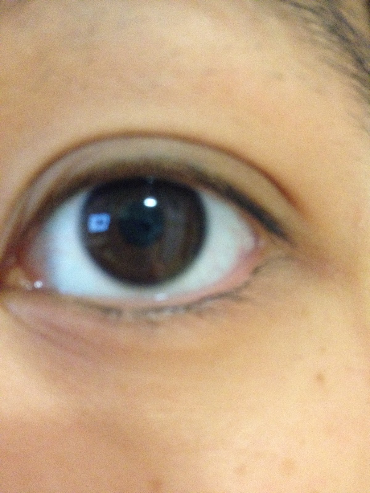 Optrex Eyedew Dazzling Buying the very Best